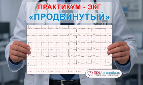 Курс ЭКГ-практикум «ПРОДВИНУТЫЙ» (Пробная версия)